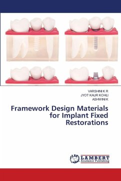 Cover Framework Design Materials for Implant Fixed Restorations