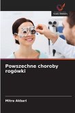 Powszechne choroby rogówki Powszechne choroby rogówki