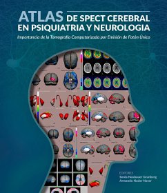 Cover Atlas de spect cerebral en psiquiatria y neurología (eBook, ePUB)