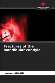 Fractures of the mandibular condyle Fractures of the mandibular condyle