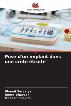 Pose d'un implant dans une crête étroite Cover Pose d'un implant dans une crête étroite