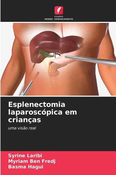 Esplenectomia laparoscópica em crianças