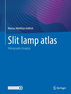 Cover Slit lamp atlas (eBook, PDF)