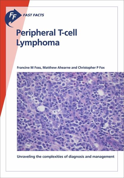 Fast Facts: Peripheral T-cell Lymphoma (eBook, ePUB) Fast Facts: Peripheral T-cell Lymphoma (eBook, ePUB)