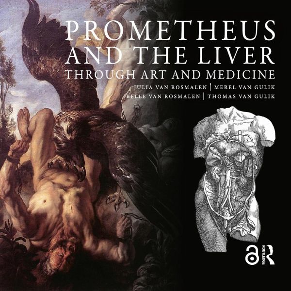 Prometheus and the Liver through Art and Medicine (eBook, ePUB) Prometheus and the Liver through Art and Medicine (eBook, ePUB)