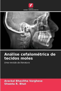 Cover Análise cefalométrica de tecidos moles