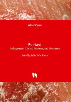 Psoriasis - Pathogenesis, Clinical Features, and Treatment Psoriasis - Pathogenesis, Clinical Features, and Treatment