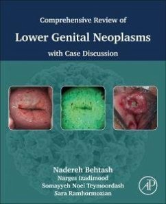Comprehensive Review of Lower Genital Neoplasms - Behtash, Nadereh; Izadimood, Narges; Ramhormozian, Sara; Teymoordash, Somayyeh Noei