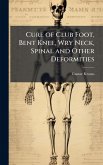 Cure of Club Foot, Bent Knee, Wry Neck, Spinal and Other Deformities
