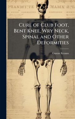 Cover Cure of Club Foot, Bent Knee, Wry Neck, Spinal and Other Deformities