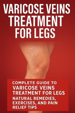 Cover Varicose Veins Treatment for Legs: Natural Varicose Veins Treatment Remedies, Exercises and Pain Relief Tips (eBook, ePUB)