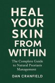 Heal Your Skin From Within: The Complete Guide to Natural Psoriasis Management By Dan Cranfield (eBook, ePUB)