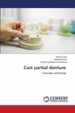 Cast partial denture