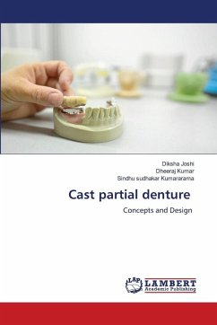 Cover Cast partial denture