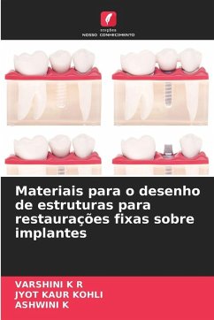 Cover Materiais para o desenho de estruturas para restaurações fixas sobre implantes