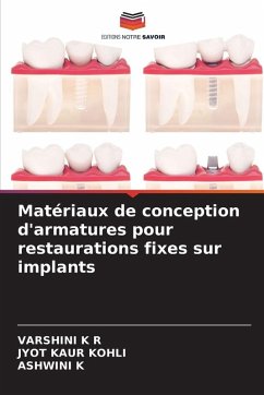 Cover Matériaux de conception d'armatures pour restaurations fixes sur implants