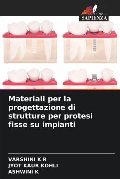 Materiali per la progettazione di strutture per protesi fisse su impianti - K R, VARSHINI;Kohli, Jyot Kaur;K, ASHWINI