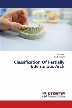 Cover Classification Of Partially Edentulous Arch