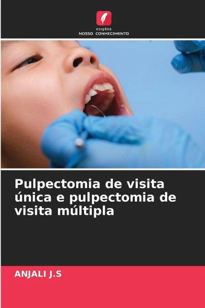 Pulpectomia de visita única e pulpectomia de visita múltipla Pulpectomia de visita única e pulpectomia de visita múltipla