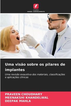 Cover Uma visão sobre os pilares de implantes