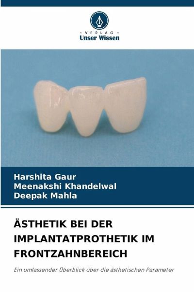 ÄSTHETIK BEI DER IMPLANTATPROTHETIK IM FRONTZAHNBEREICH ÄSTHETIK BEI DER IMPLANTATPROTHETIK IM FRONTZAHNBEREICH