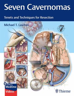 Seven Cavernomas (eBook, ePUB) - Lawton, Michael T.