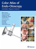 Color Atlas of Otoscopy (eBook, ePUB) Color Atlas of Otoscopy (eBook, ePUB)