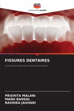 Cover FISSURES DENTAIRES