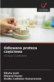 Odlewana proteza cz¿¿ciowa Odlewana proteza cz¿¿ciowa
