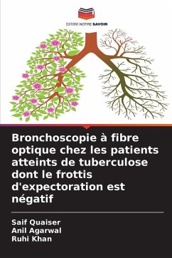 Cover Bronchoscopie à fibre optique chez les patients atteints de tuberculose dont le frottis d'expectoration est négatif