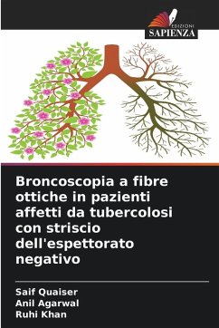 Cover Broncoscopia a fibre ottiche in pazienti affetti da tubercolosi con striscio dell'espettorato negativo