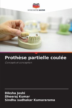 Cover Prothèse partielle coulée