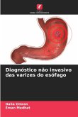 Diagnóstico não invasivo das varizes do esófago Diagnóstico não invasivo das varizes do esófago
