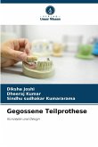 Gegossene Teilprothese Gegossene Teilprothese