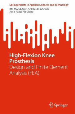 Cover High-Flexion Knee Prosthesis (eBook, PDF)