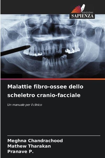 Malattie fibro-ossee dello scheletro cranio-facciale Malattie fibro-ossee dello scheletro cranio-facciale