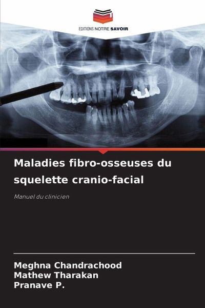 Maladies fibro-osseuses du squelette cranio-facial Maladies fibro-osseuses du squelette cranio-facial