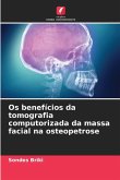 Os benefícios da tomografia computorizada da massa facial na osteopetrose Os benefícios da tomografia computorizada da massa facial na osteopetrose