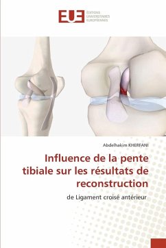 Cover Influence de la pente tibiale sur les résultats de reconstruction