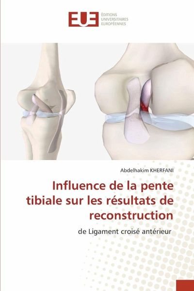 Influence de la pente tibiale sur les résultats de reconstruction