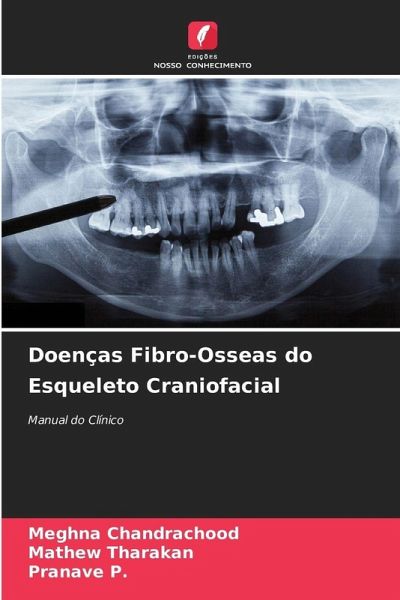 Doenças Fibro-Osseas do Esqueleto Craniofacial Doenças Fibro-Osseas do Esqueleto Craniofacial