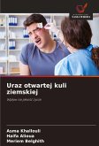 Uraz otwartej kuli ziemskiej