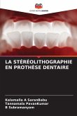 LA STÉRÉOLITHOGRAPHIE EN PROTHÈSE DENTAIRE