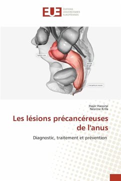 Cover Les lésions précancéreuses de l'anus