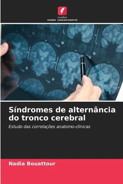 Síndromes de alternância do tronco cerebral - Bouattour, Nadia