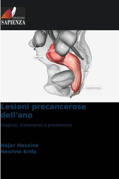 Cover Lesioni precancerose dell'ano