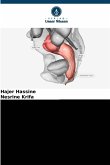 Präkanzeröse Läsionen des Anus Präkanzeröse Läsionen des Anus