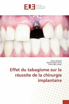 Effet du tabagisme sur la réussite de la chirurgie implantaire - Khenfir, Faten;Ben Attia, Dhouha;Ben Amor, Faten Effet du tabagisme sur la réussite de la chirurgie implantaire - Khenfir, Faten;Ben Attia, Dhouha;Ben Amor, Faten