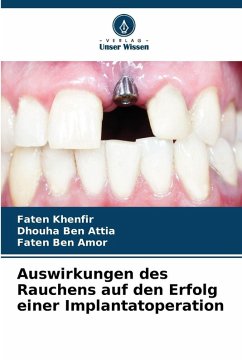 Cover Auswirkungen des Rauchens auf den Erfolg einer Implantatoperation