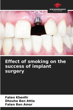 Effect of smoking on the success of implant surgery - Khenfir, Faten;Ben Attia, Dhouha;Ben Amor, Faten Effect of smoking on the success of implant surgery - Khenfir, Faten;Ben Attia, Dhouha;Ben Amor, Faten